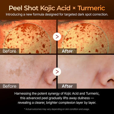 Summer Exclusive | 10-Step Skin Renewal Routine Set