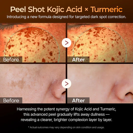 Summer Exclusive | 10-Step Skin Renewal Routine Set