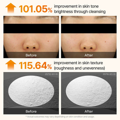 Summer Exclusive | 10-Step Skin Renewal Routine Set