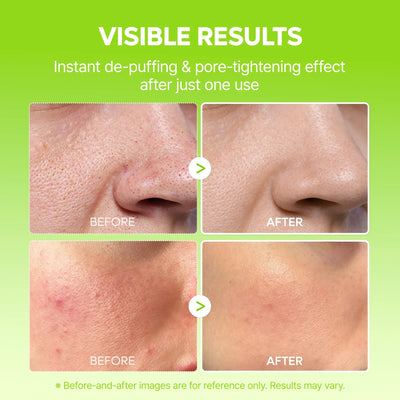 Summer Exclusive | 10-Step Skin Renewal Routine Set
