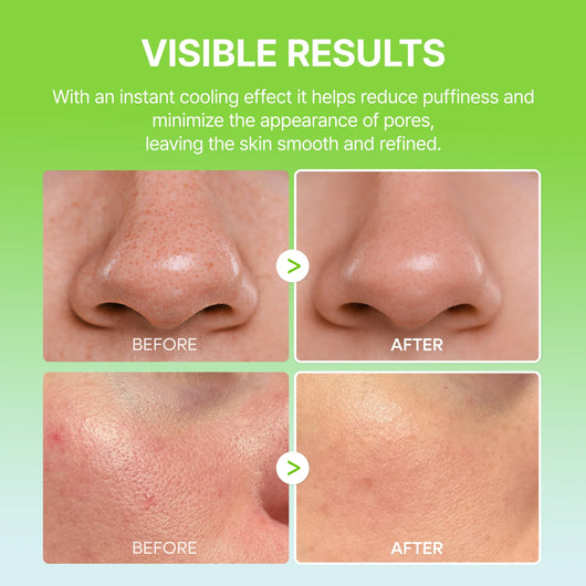 Summer Exclusive | 10-Step Skin Renewal Routine Set